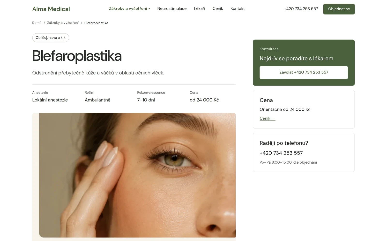 Alma Medical – detail zákroku blefaroplastika